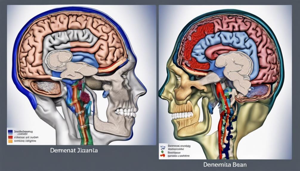 dementia brain scan variances