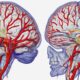 diagnosis of vascular dementia