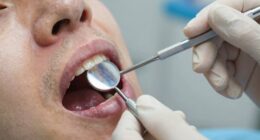 dental procedures influence medication