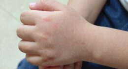 missed fracture warning signs