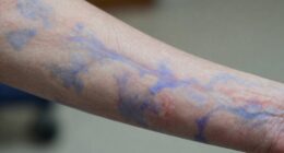 signs of skin deterioration