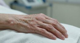 skin issues in immobility