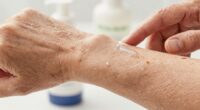 elderly dry skin relief