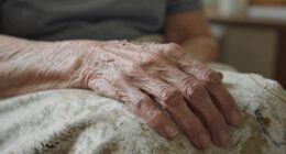 overlooked signs of frailty